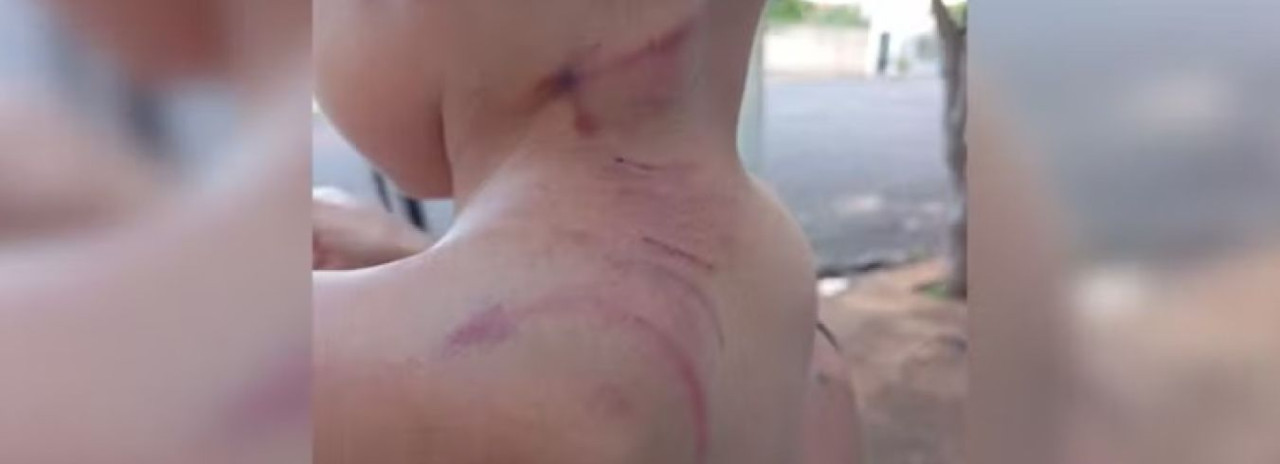 Mulher grávida e filho de 3 anos são atacados por cachorro enquanto caminhavam pela rua