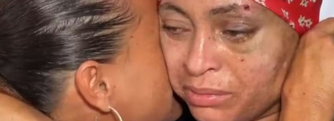 Mulher dada como morta por engano após atropelamento recebe alta depois de quase 20 dias internada