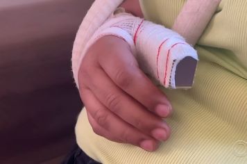 Preso por morder e arrancar parte do dedo de mulher: “Você não sabe com quem mexeu”