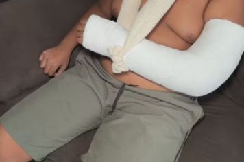 Adolescente com autismo tem braço quebrado após agressão dentro de escola estadual, denuncia mãe