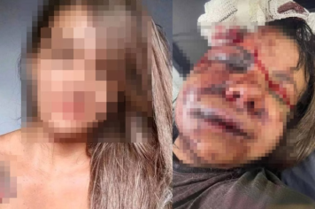 Ex-jogador de basquete é preso após espancar ex-namorada com mais de 60 socos dentro de elevador  