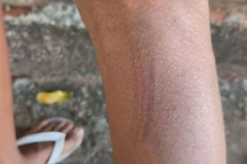 Adolescente denuncia agressão após ser acusado injustamente de furto em mercado