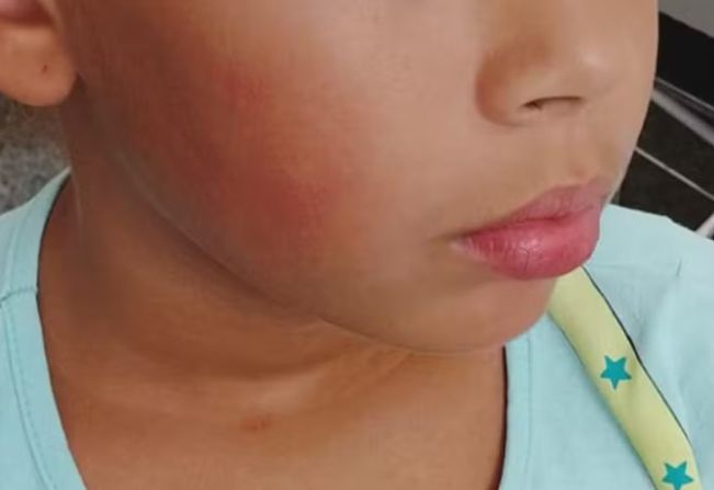 Monitora é afastada por suspeita de dar tapa no rosto de criança em ônibus escolar em General Salgado