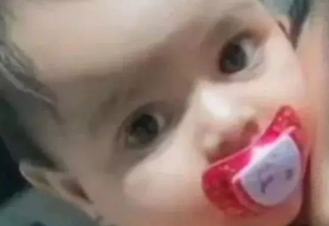 Bebê de 1 ano é atropelada por motociclista e fica em estado gravíssimo