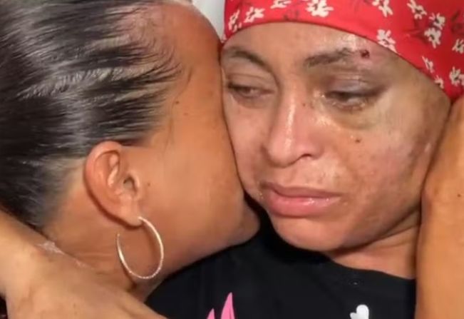 Mulher dada como morta por engano após atropelamento recebe alta depois de quase 20 dias internada