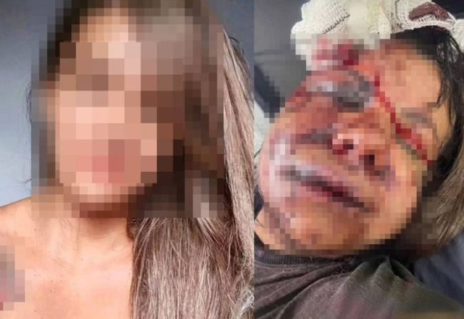 Ex-jogador de basquete é preso após espancar ex-namorada com mais de 60 socos dentro de elevador  
