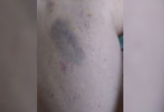 Professora deixa cargo após sofrer agressões de alunos em escola pública